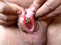 Genital piercing